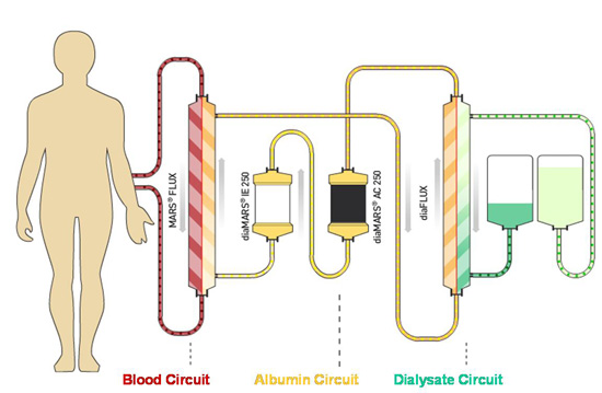 Dialysis