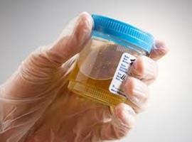 Symptoms of Kidney Failure