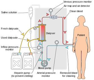 Dialysis