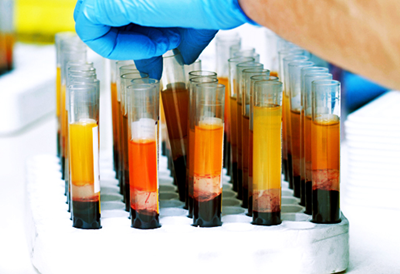 Antibody Subsets