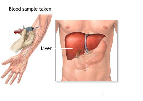 albumin