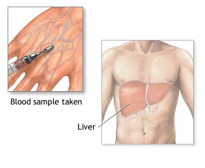 Blood Lipid