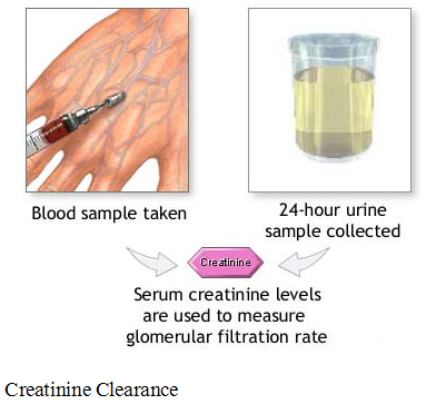 creatinine-clearance