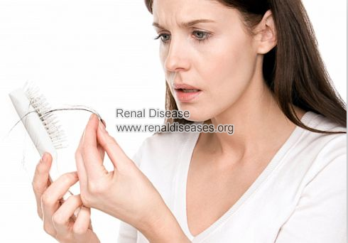 Hair Loss with Stage 4 Kidney Disease