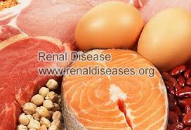 How Much Protein Can Patients with IgA Kidney Disease Eat