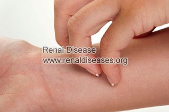 What Make the Itchy Skin with Kidney Failure