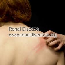 Does Reduced Kidney Function Cause Itching Skin