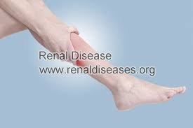 How to Prevent Leg Cramps During Dialysis