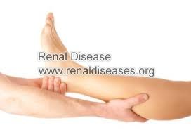 End-stage Renal Failure: How to Help Leg Cramps during dialysis