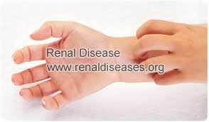 The Causes of Itchy Skin in Renal Failure