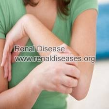 What Causes Itchy Skin in Dialysis Patients with FSGS