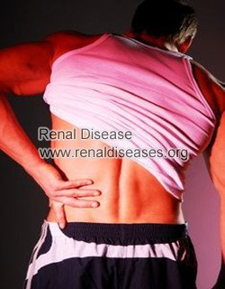 Can Cortical Cyst Cause Flank Pain