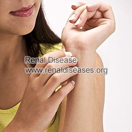 Effective Treatments for Itchy Skin in Chronic Kidney Failure