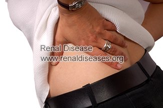 Back Pain in PKD: Causes and Treatments 