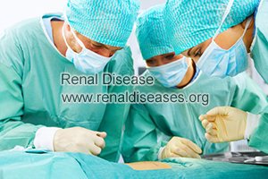 Is Surgery the Only Treatment Option for Cysts in PKD