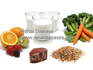 How to Decrease High Creatinine Level through Diet