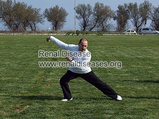 Tops 4 Ways to Improve the Prognosis of Kidney Cyst