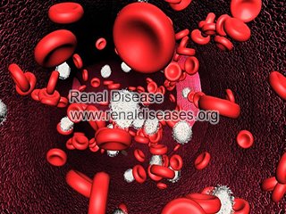 Causes and Treatments of Anemia in Polycystic Kidney Disease
