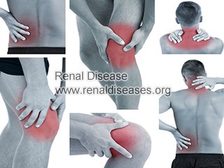 Can IgA Nephropathy Cause Joint Pain