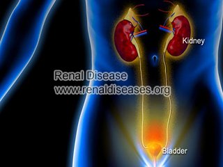 Can PKD Patients Have Urinary Tract Infection