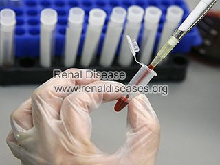 Common Tests For PKD