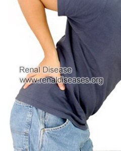 Is Back Pain A Sign of Kidney Failure