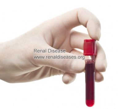 How to Reduce Blood Urea Nitrogen in CKD Stage 4 Patients