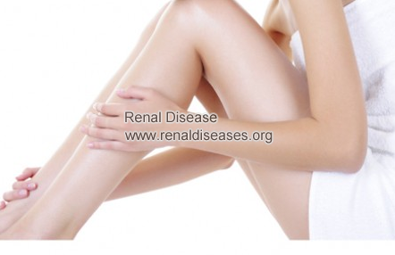 Causes and Treatments for Restless Leg Syndrome in CKD 