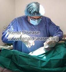 Is Surgery the Best Treatment for PKD