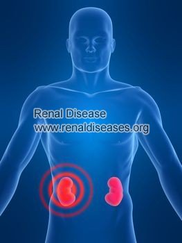 Is Polycystic Liver Related to Polycystic Kidney Disease
