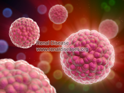 How to Reduce Proteinuria in IgA Nephropathy with Immunotherapy