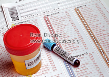 How to Control Blood Urine in FSGS Patients