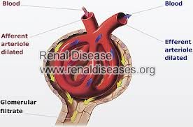 What does a GFR 48 Mean in IgA Nephropathy