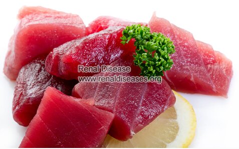 How to Deal with Creatinine 4.8 in Diabetic Nephropathy