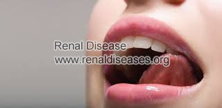 Dry Mouth in CKD Stage 4