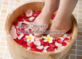 Chinese Therapies for Renal Cortical Cyst 6cm