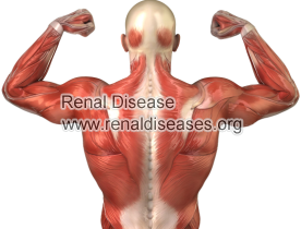 Muscle Contraction And End Stage Kidney Disease