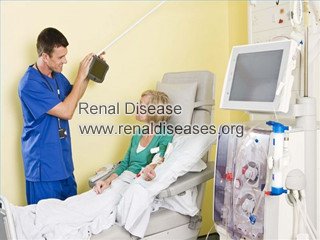 Top 5 Facts of Dialysis