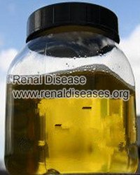 Three Common Manifestations of Changes of Urine Volume in Kidney Disease