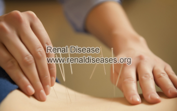 How to Treat Back Pain in PKD