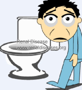 Why Does Lupus Nephritis Patients Have Frequent Urination