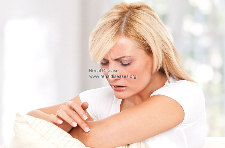Why PKD Patients have Have Dry Skin