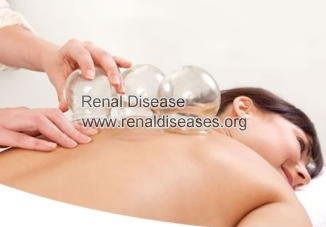 Is Cupping Safe for People with Diabetes