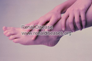 Can FSGS Cause Numbness in Legs