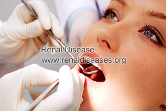 Ammonia Breath and Metallic Taste in Glomerulonephritis