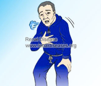 Shortness of Breath After Dialysis