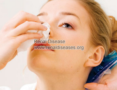 Nose Bleeding And CKD: Causes and Treatment