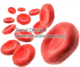 High Creatinine And Low Hemoglobin in Hypertensive Nephropathy