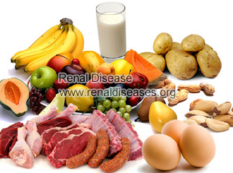 IgA Nephropathy Diet Restrictions  