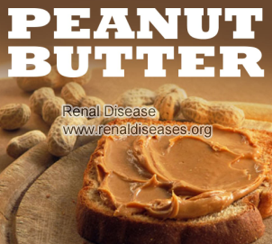 Can A Person with High Creatinine Eat Peanut Butter